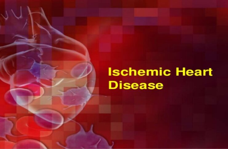 Ischemic Heart Disease - Lifestyle and Diet Modifications